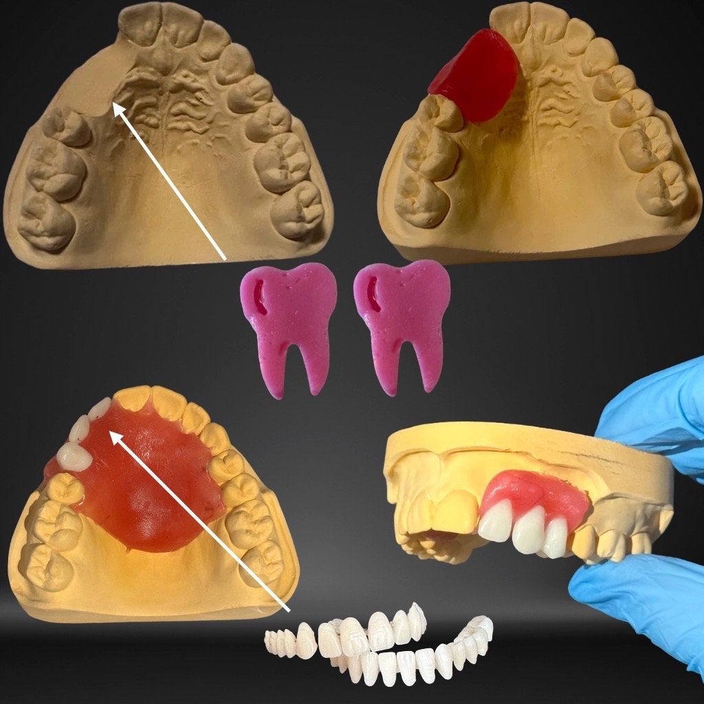 Craft Your Model, Learn Model, Dental Fix Kit, Diy Denture Show Model Prothesis Model von DentalMental