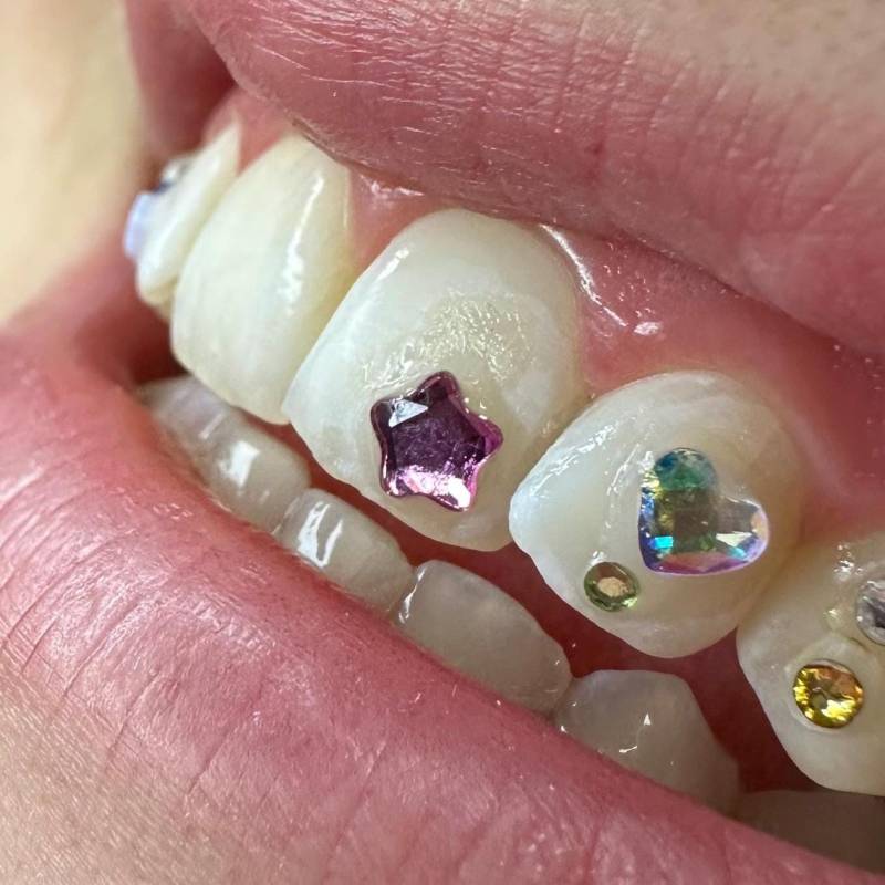 Blume Tooth Gem | Swarovski - Verschiedene Farben von FairysToothGems