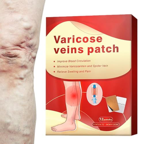 Bein-Patches | Leg Circulation Paste für Männer Frauen | Beruhigende Beinflicken Massagebehandlung reduziert Spinnenvenen und lindert schwere Beine und von Jlobnyiun