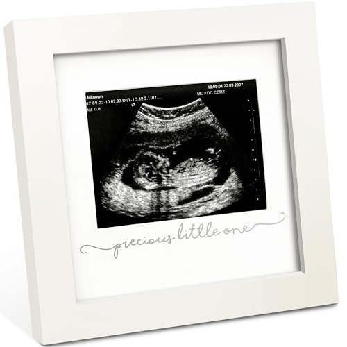 Baby Bilderrahmen für Ultraschallbilder – Bilderrahmen Ultraschallbild Baby, Baby Ultraschall Bilderrahmen Schwangerschaft Geschenke für Werdende Mamas, Ultraschallbilder Rahmen(Alpine White) von KeaBabies