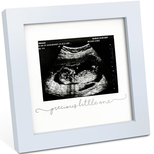 Baby Bilderrahmen für Ultraschallbilder – Bilderrahmen Ultraschallbild Baby, Baby Ultraschall Bilderrahmen Schwangerschaft Geschenke für Werdende Mamas, Ultraschallbilder Rahmen ​(Mist Blue) von KeaBabies