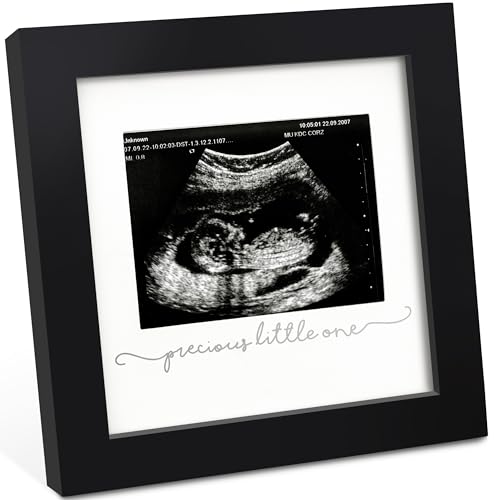 Baby Bilderrahmen für Ultraschallbilder – Bilderrahmen Ultraschallbild Baby, Baby Ultraschall Bilderrahmen Schwangerschaft Geschenke für Werdende Mamas, Ultraschallbilder Rahmen ​(Onyx Black) von KeaBabies