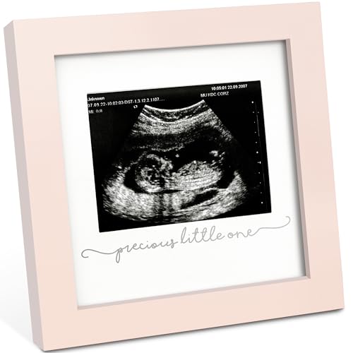 Baby Bilderrahmen für Ultraschallbilder – Bilderrahmen Ultraschallbild Baby, Baby Ultraschall Bilderrahmen Schwangerschaft Geschenke für Werdende Mamas, Ultraschallbilder Rahmen ​(Petal Pink) von KeaBabies