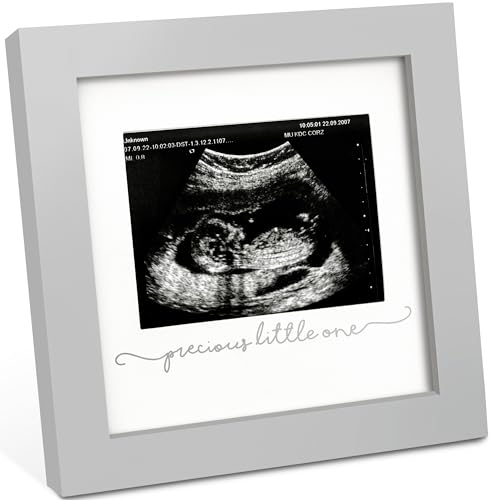 Baby Bilderrahmen für Ultraschallbilder – Bilderrahmen Ultraschallbild Baby, Baby Ultraschall Bilderrahmen Schwangerschaft Geschenke für Werdende Mamas, Ultraschallbilder Rahmen ​(Cloud Gray) von KeaBabies