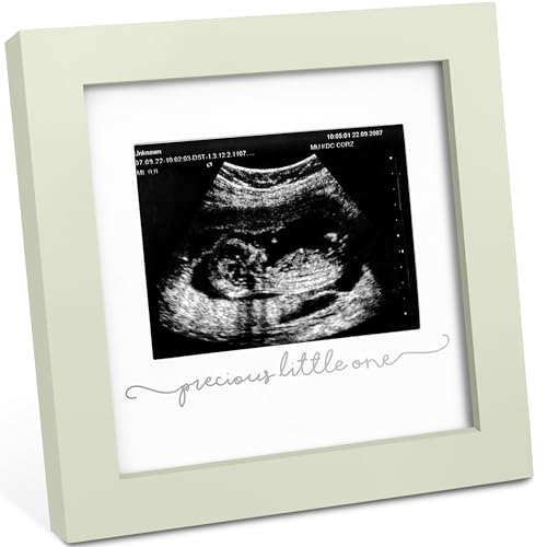 KeaBabies Baby Bilderrahmen für Ultraschallbilder – Bilderrahmen Ultraschallbild Baby, Baby Ultraschall Bilderrahmen Schwangerschaft Geschenke für Werdende Mamas, Ultraschallbilder Rahmen ​(Sage) von KeaBabies