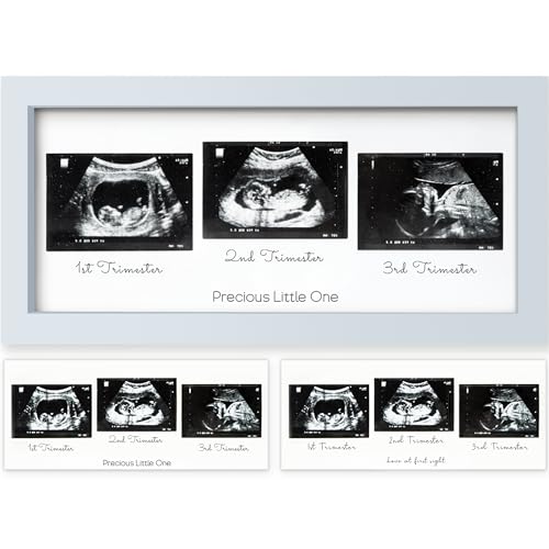 Trio Baby Bilderrahmen für Ultraschallbilder - Bilderrahmen Ultraschallbild Baby, Ultraschall Bilderrahmen Schwangerschaft, Ultraschallbilder Rahmen, Geschenke für Werdende Mamas (Mist Blue) von KeaBabies