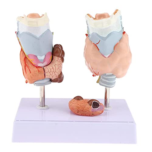 Anatomisches Modell der menschlichen Schilddrüse, Nachbildung der Anatomie des menschlichen Körpers einer Schilddrüse mit Erkrankungen für die Arztpraxis, Lehrmittel, normales und erkranktes anatomisc von MFYHMY