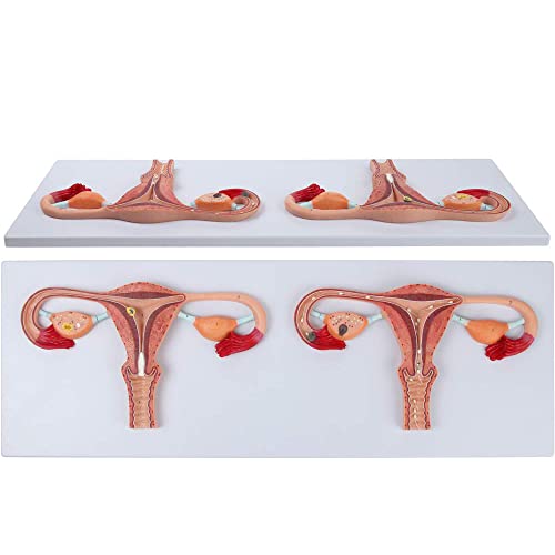 MFYHMY Anatomisches Befruchtungsprozessmodell, menschliches Befruchtungsprozessmodell, die weiblichen Fortpflanzungsorgane von Gebärmutter, Eierstöcken und Eileitern für Studien von MFYHMY