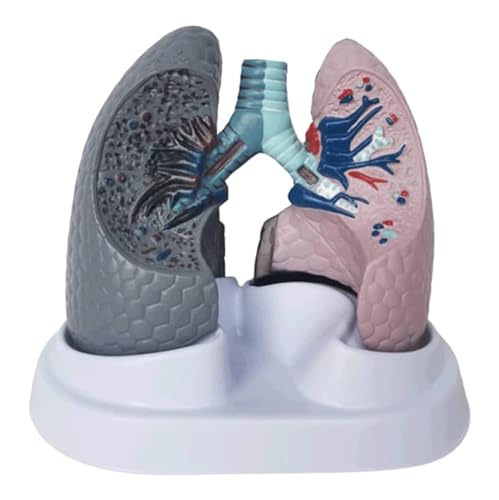 Menschliches Organmodell, Modell der menschlichen Lungenanatomie, Modell des Dampfens und gesundes Organmodell des menschlichen Atmungssystems als didaktische Unterstützung für die Studie von MFYHMY