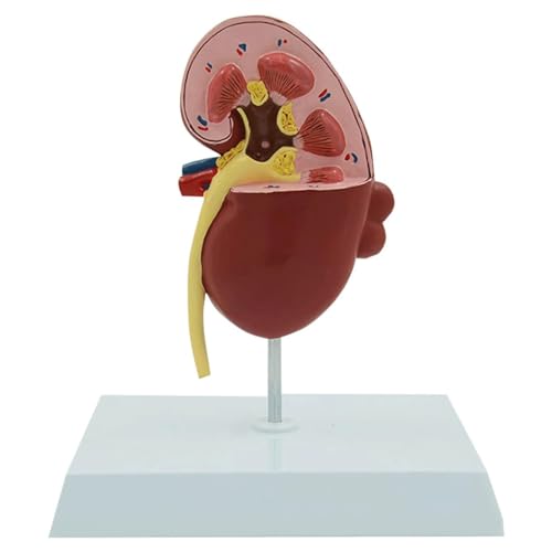 Menschliches Organmodell, Modell der menschlichen Nierenanatomie, Modell der pathologischen Niere, professionelles Modell als medizinische Bildungsbeihilfe für das Schulstudium von MFYHMY