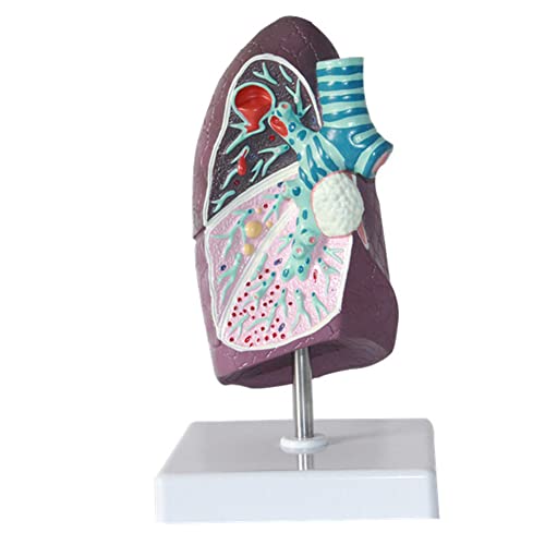 Menschliches pathologisches Lungenmodell, Lungenorgan-medizinisches menschliches pathologisches anaisches Atmungssystemmodell, Nachbildung der menschlichen Körperanatomie der Lunge für das Lehrmittel von MFYHMY