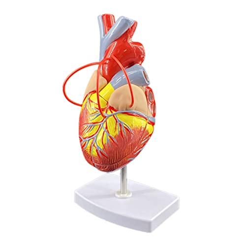 Modell der Anatomie des menschlichen Körpers, Modell des Herz-Bypass-Modells des menschlichen Herzens mit abnehmbarem 2-teiligen Modell für die kardiologische Lehre, medizinische Lehre, Krankenhäuser, von MFYHMY