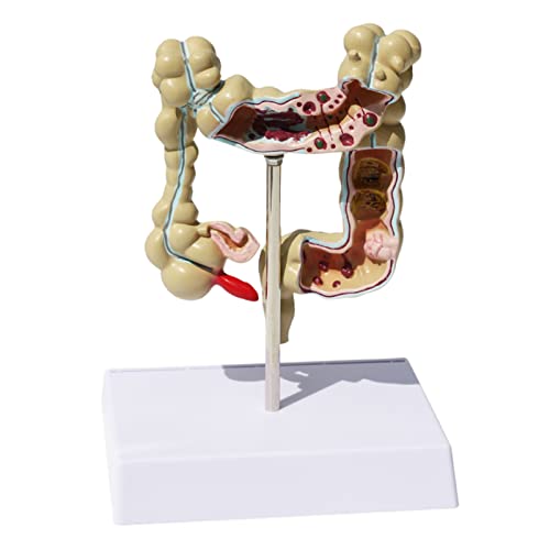 Modell des menschlichen Korps, Crassus-Darm, anatomisches Modell des Verdauungssystems, medizinische Demonstration, didaktische Ressourcen, Krankenhaus, menschliches Lernwerkzeugmodell von MFYHMY