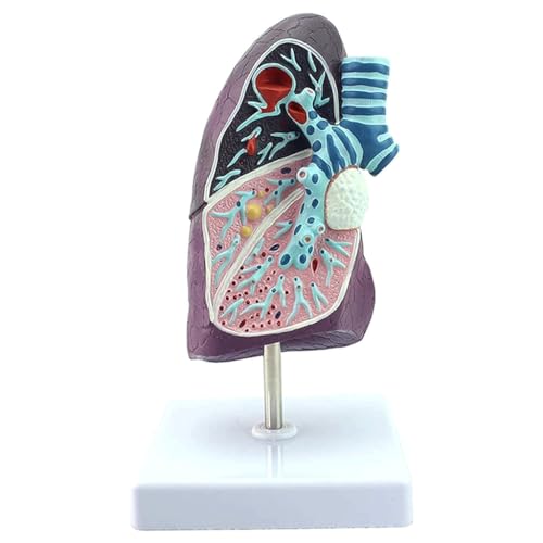 Modell des menschlichen Organs, anatomisches Modell der menschlichen Lunge, Lungenmodell, Didaktik des menschlichen Körpers für die Medizin-Patienten-Kommunikation für das Schulstudium von MFYHMY