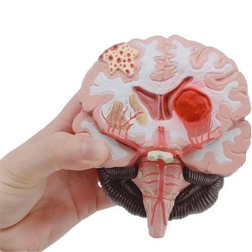 Modell eines menschlichen Organs. Anatomisches Modell des menschlichen Gehirns. Modell der Gehirnstammabteilungen des menschlichen Gehirns. Didaktisches Modell für die Schulstudie von MFYHMY
