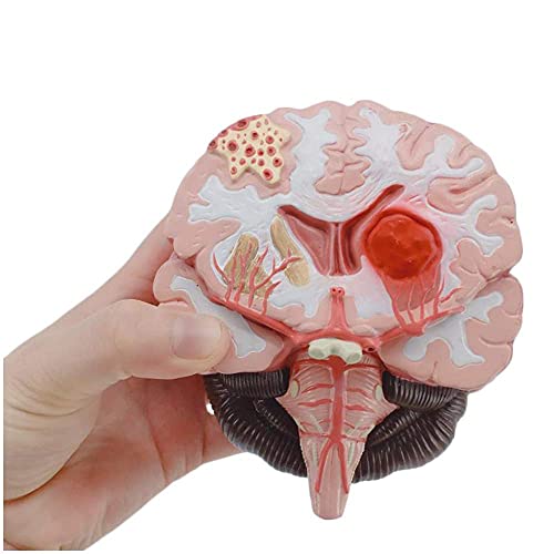 Zerebrales Modell der Montage, zerebrales Kortex-anatomisches graues Material des zerebralen Rumpfes, Modell der Anatomie, arterovenöses Lehrmaterial für die Schule von MFYHMY