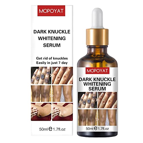 Tumotsit Dunkle Knöchel-Entferner | 50ml Dark Knuckles Radiergummi - Elbow Whiten Essence, Entferner für dunkle Flecken zum Entfernen von dunklen Knöcheln, Fingern, Ellenbogen, Knien und Knöcheln von Tumotsit