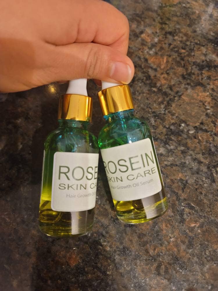 Rosmarin Haar-Wachstum-Öl-Serum | Bartwuchsöl Serum Kopfhautöl Rosmarin-Haarwuchsöl von roseinskincares